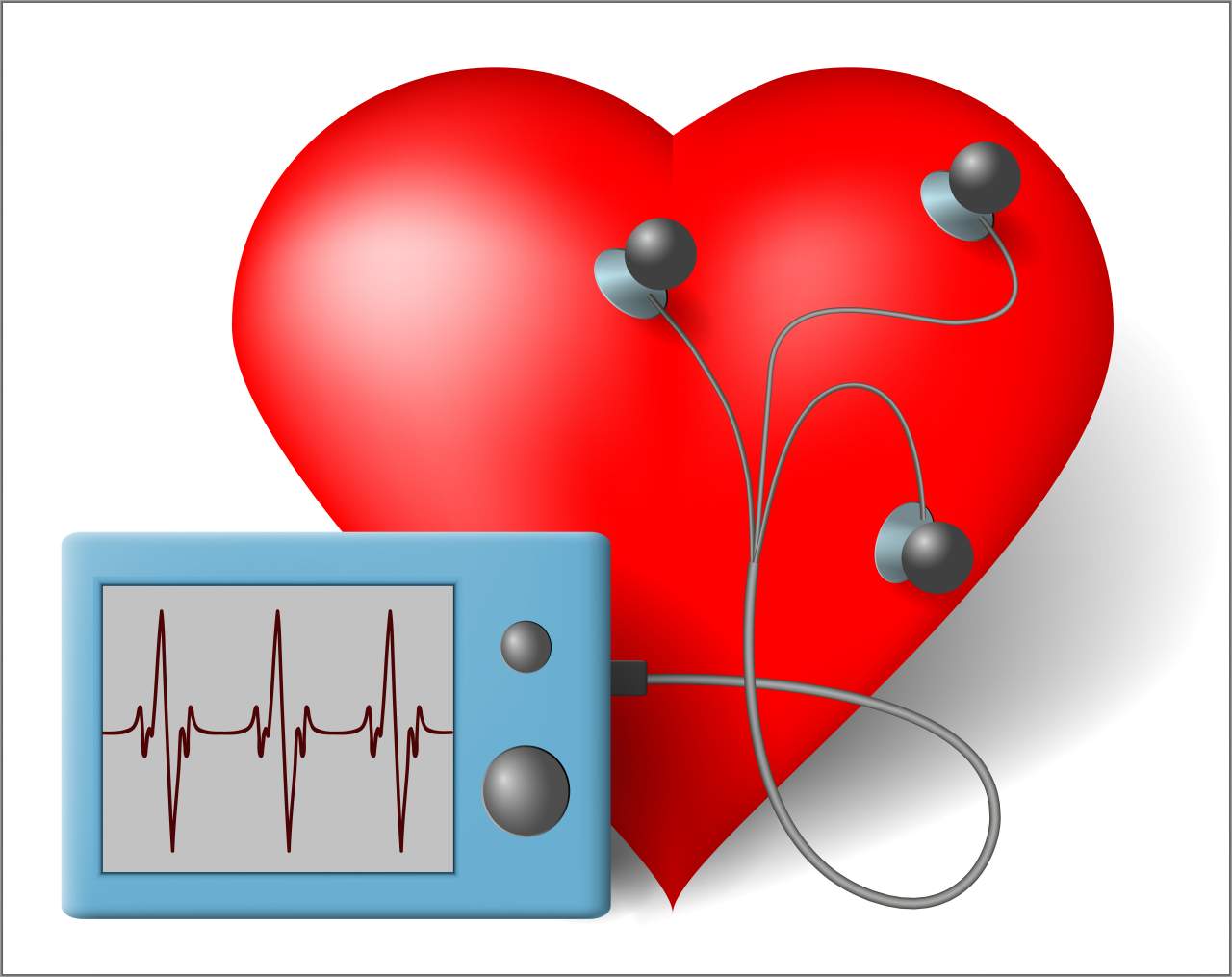 Los 10 mejores monitores de frecuencia cardíaca para el pecho