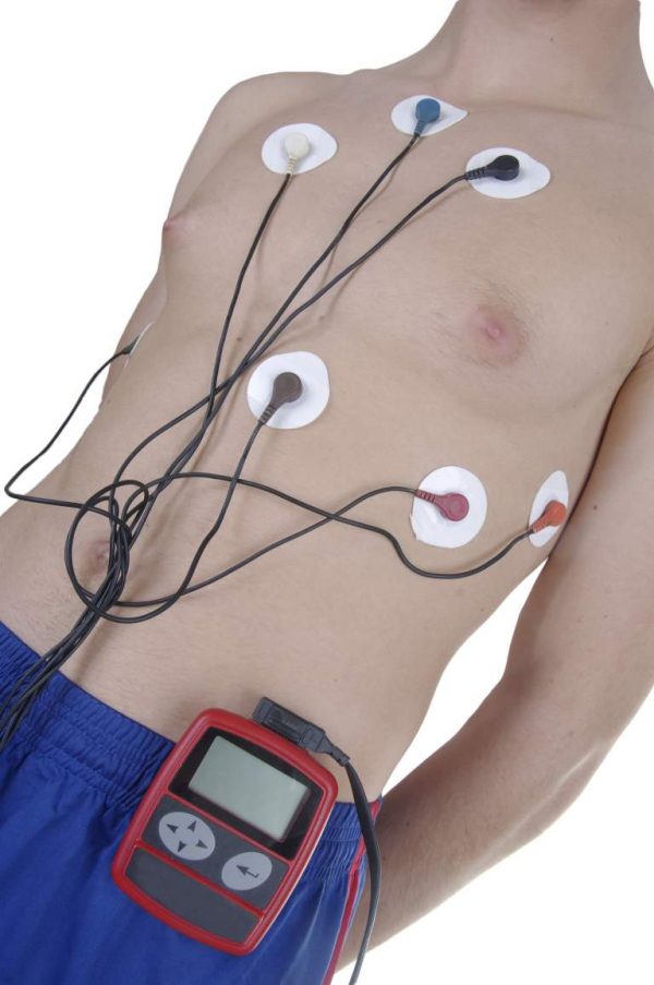 Holter con 5 sensores en el pecho